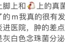 字母圈恋jio，嘴会不会被感染脚气？-瘾欢